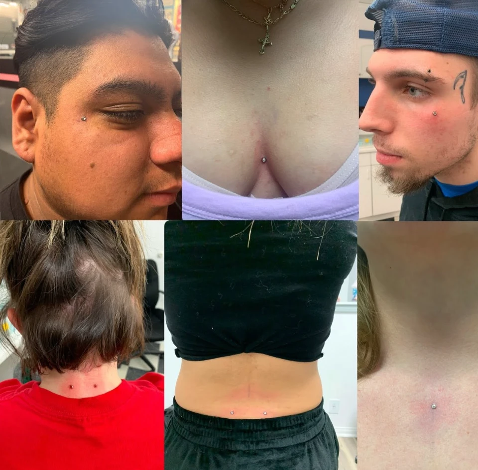 Dermal anchor piercings on the cheek, chest, nape of the neck, lower back and collarbone