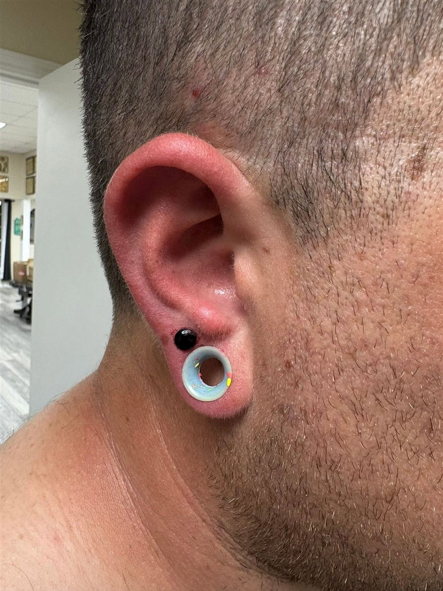 Stretched ear lobe piercing with opal tunnel jewelry